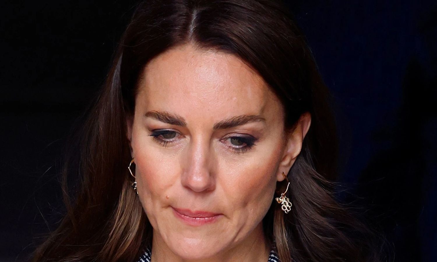 Kate Middleton: Chemo Has Ended, But Pain Hasn't, Which Is Causing Her Pain